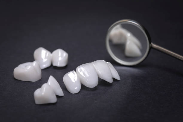 Layered Zirconia