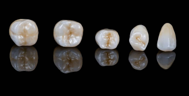 Esthetic Zirconia